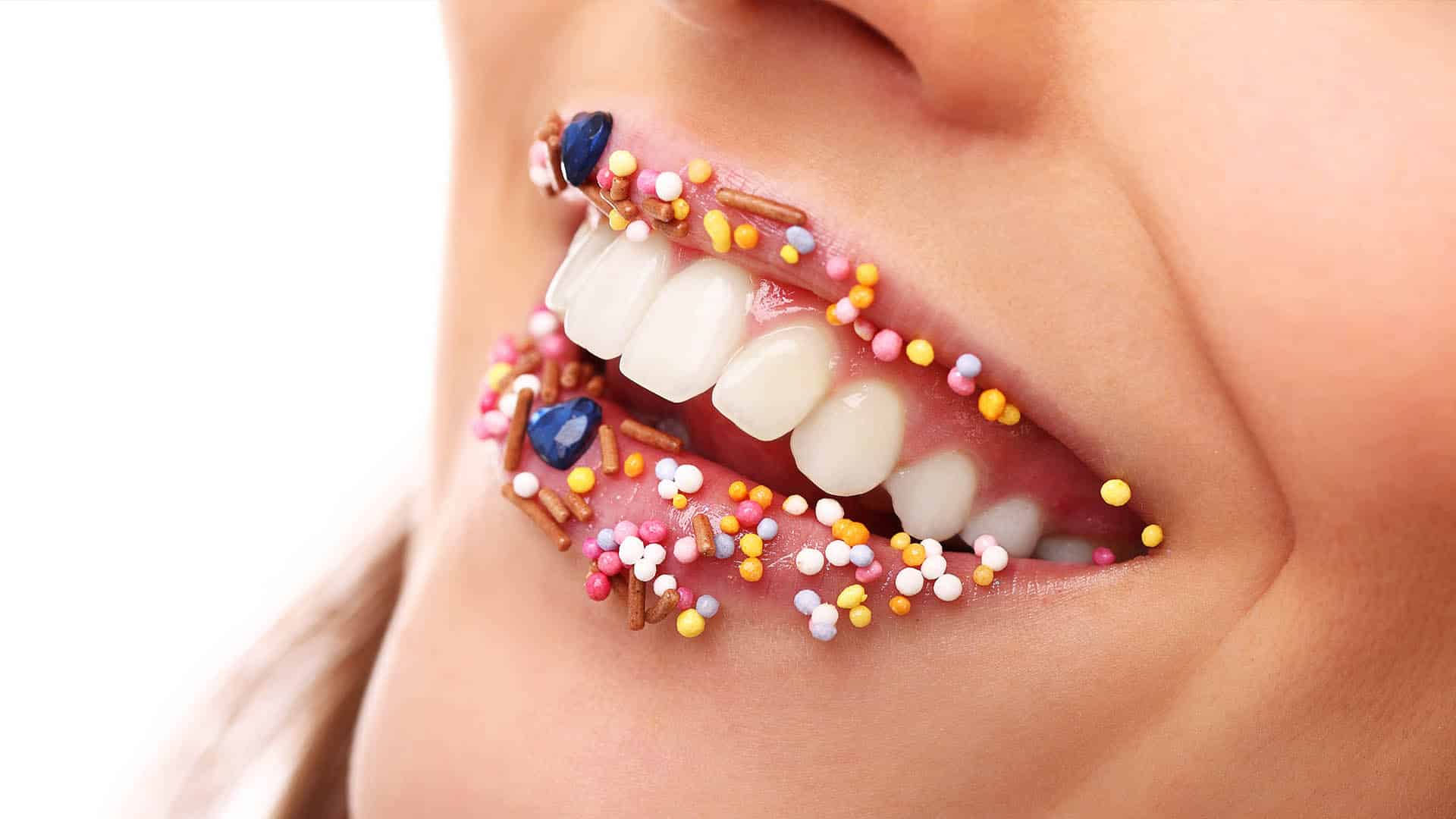 سفید کردن دندان در استانبول